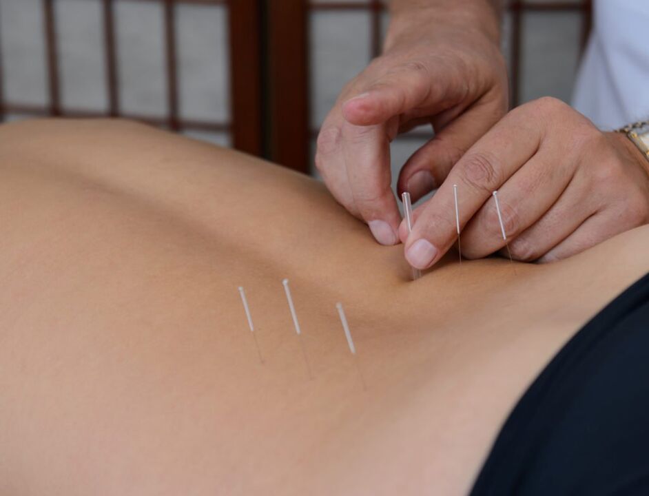 akupunktúra prosztatagyulladásra